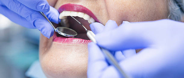 Best Emergency Root Canal Therapy in Deale, MD